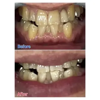 M渋谷店所属・M渋谷 ホワイトニングのエステ・リラクイメージ