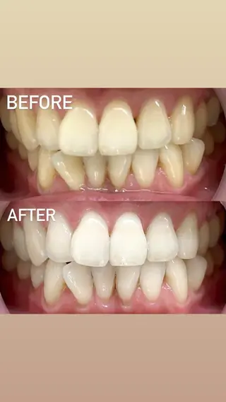 LBSホワイトニング 銀座店💎店長浦和のその他イメージ