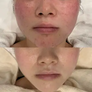 べアール所属・小顔/毛穴/ニキビ salon bealのエステ・リラクイメージ