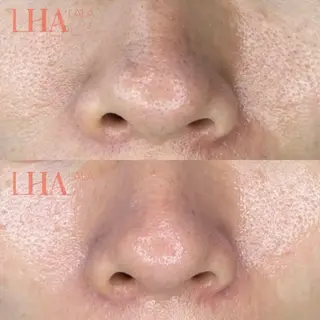 M FLOAT skin salonのエステ・リラクイメージ