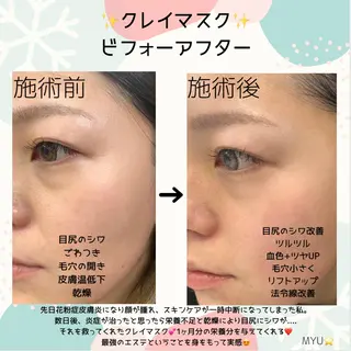 ミューズエステ 谷口美結のエステ・リラクイメージ