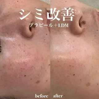 韓国肌管理&小顔 ＩＲＯＨＡのエステ・リラクイメージ