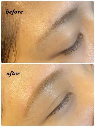 アイブロウ ハーブピーリング/韓国肌管理/フェイシャル/毛穴洗浄/眉毛/顔脱毛【糸脱毛専門】rev所属・ハーブピーリング🌹 毛穴洗浄❤️眉waxのエステ・リラクイメージ