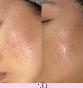 Blooming所属・LOUISE. ／肌質・頭皮のエステ・リラクイメージ