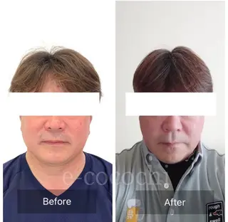 小顔と ヘッドスパのお店のエステ・リラクイメージ