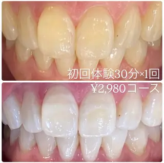 PLATINUM Beauty 横浜店所属・ホワイトニングルーム 横浜店のその他イメージ