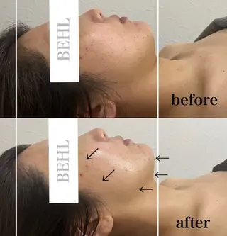 BeautySalonBEHL所属・鶴ヶ島BEHL 村山のエステ・リラクイメージ