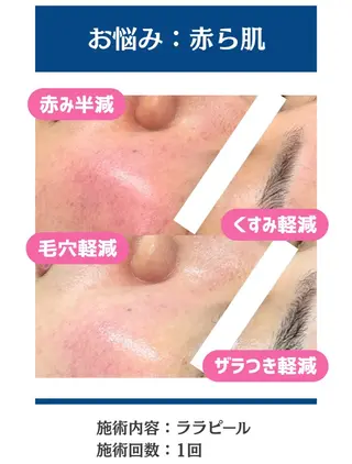 毛穴レス美肌へ🌿 看護師Abe🌼のエステ・リラクイメージ