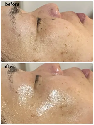 肌質改善専門店/絹々(きぬ)所属・心満たされる ハーブピーリング絹々のエステ・リラクイメージ