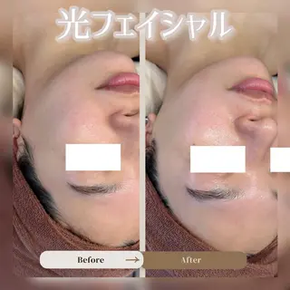 REJUSALON JURIのエステ・リラクイメージ