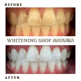 メンズ ホワイトニング ショップ高田馬場店のその他イメージ