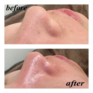 Glanz Beauty所属・Glanz Beautyの眉毛・アイブロウイメージ