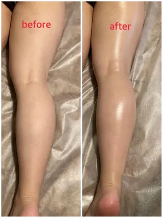 bellissimo 【ベリッシモ】所属・ちひろ　痩身/ハーブ bellissimoのエステ・リラクイメージ