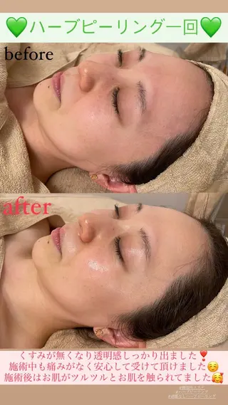 メンズ Salon de Lino 御器所のエステ・リラクイメージ