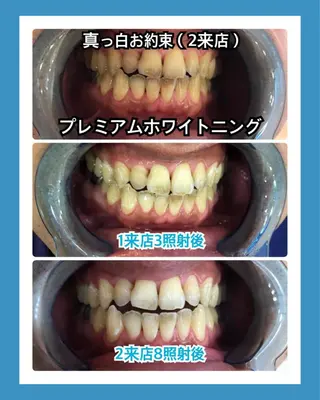 PLATINUM Beauty 横浜店所属・ホワイトニングルーム 横浜店のその他イメージ