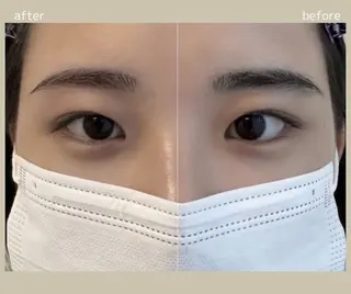 アイブロウ 眠りの森/脱毛眉毛/ マッサージ/RINAのエステ・リラクイメージ