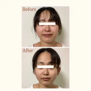 笑媛うさぎ 快眠美容専門サロンのエステ・リラクイメージ