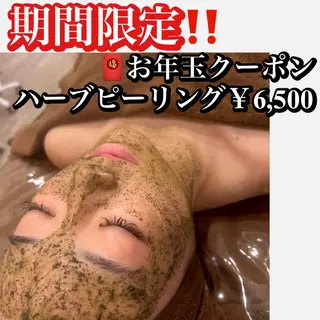 White Calm 天王寺所属・ハーブピーリング White Calmのその他イメージ