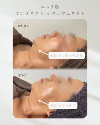 AMO. もえのエステ・リラクイメージ