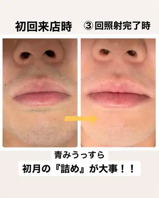 メンズ メンズ脱毛サロン Le falcoのエステ・リラクイメージ