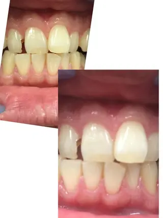 WhiteningSquare by Avanti所属・ホワイトニングスクエ ア by アバンティのその他イメージ