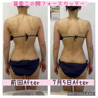 ブライダル痩身×脱毛 尼崎駅前サロンのエステ・リラクイメージ