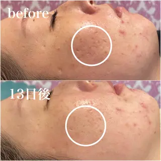 毛穴レス ハーブ＆ ワックス脱毛×光脱毛のエステ・リラクイメージ