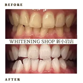 メンズ ホワイトニング ショップ新小岩店のその他イメージ