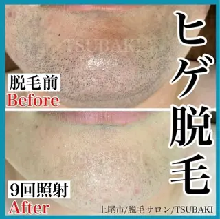 メンズ TSUBAKI上尾店所属・TSUBAKI上尾店 松下のエステ・リラクイメージ