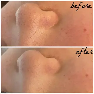 メンズ メナード岐阜市茜部 杉浦のエステ・リラクイメージ