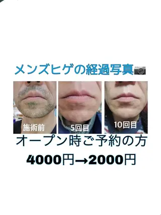 美肌脱毛サロンGrande所属・別府脱毛サロン Grandeのエステ・リラクイメージ