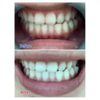 M渋谷店所属・Ｍ渋谷 ホワイトニングのエステ・リラクイメージ