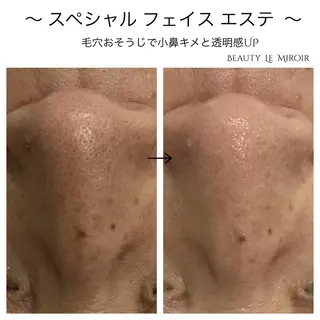 ビューティー ミロワールのエステ・リラクイメージ