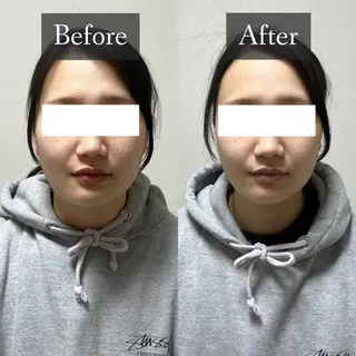 脱毛専門サロン BELFINE恵比寿のエステ・リラクイメージ