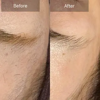 産毛専門店 Bittoのエステ・リラクイメージ