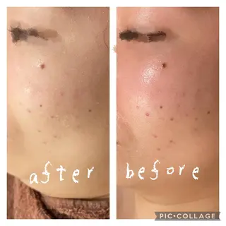 セミロング カラー パーマ ヘアアレンジ メンズ キッズ ネイル マツエク・マツパ アイブロウ ニキビ特化型エステ 🍓最短で肌質改善のエステ・リラクイメージ