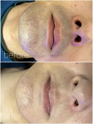 メンズ 羽生 杏菜のエステ・リラクイメージ