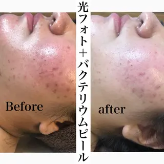 美肌脱毛と癒しのﾌﾟﾗｲﾍﾞｰﾄｻﾛﾝ。gratia~ｸﾞﾚｲﾃｨｱ~所属・gratia ~ｸﾞﾚｲﾃｨｱ~のエステ・リラクイメージ