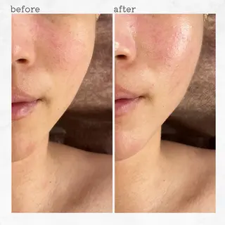 眉とお肌の専門サロン RioL / Aiのエステ・リラクイメージ