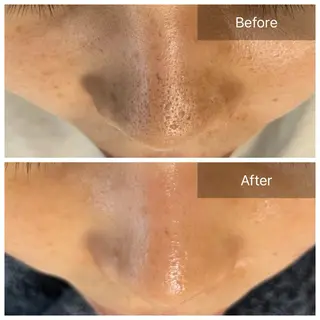 毛穴が見えなくなるサロン  Horo所属・岡 えり子のエステ・リラクイメージ