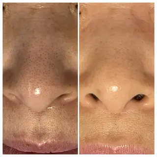 成宮鍼灸整骨院 & total  beauty  salon所属・中村 優美のエステ・リラクイメージ