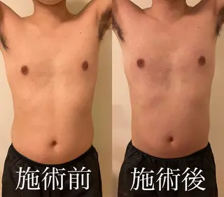 WOM SALON所属・MIKU【美容整形ダ ウンタイムケア銀座】のエステ・リラクイメージ