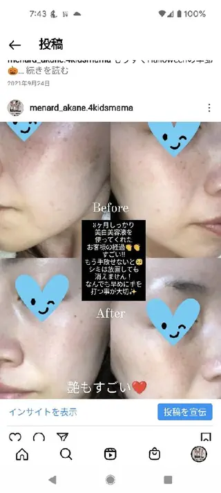 メナードフェイシャルサロン深井清水店所属・吉田 茜のエステ・リラクイメージ