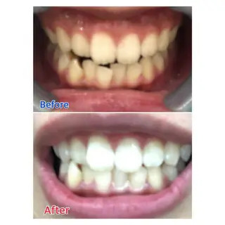 MBEAUTYSALON 千葉店・京成大久保所属・Melty 輝のその他イメージ