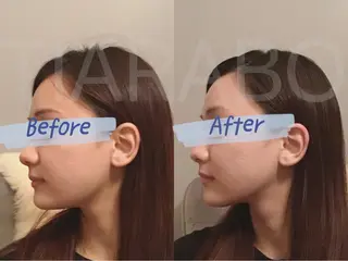 TIARABO 小顔特化美容鍼のエステ・リラクイメージ