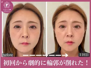 盛れる小顔矯正師 たく先生のエステ・リラクイメージ