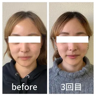 小顔サロン AMYONのエステ・リラクイメージ