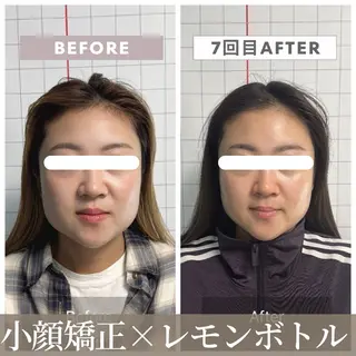 小顔矯正専門店 【RED】池田のエステ・リラクイメージ