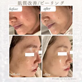 Lily branc 痩身/小顔/肌質改善のエステ・リラクイメージ