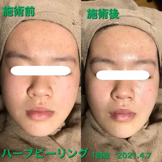 La.pport ラポールのエステ・リラクイメージ